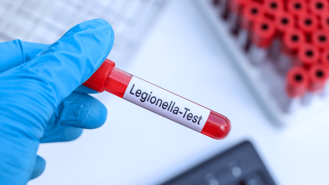 Test per la Legionella