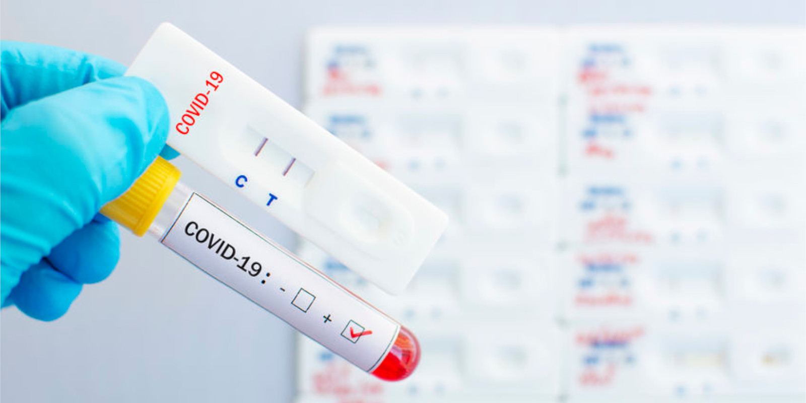 Tamponi Covid-19 presso la Vs. azienda – segnalazione partner
